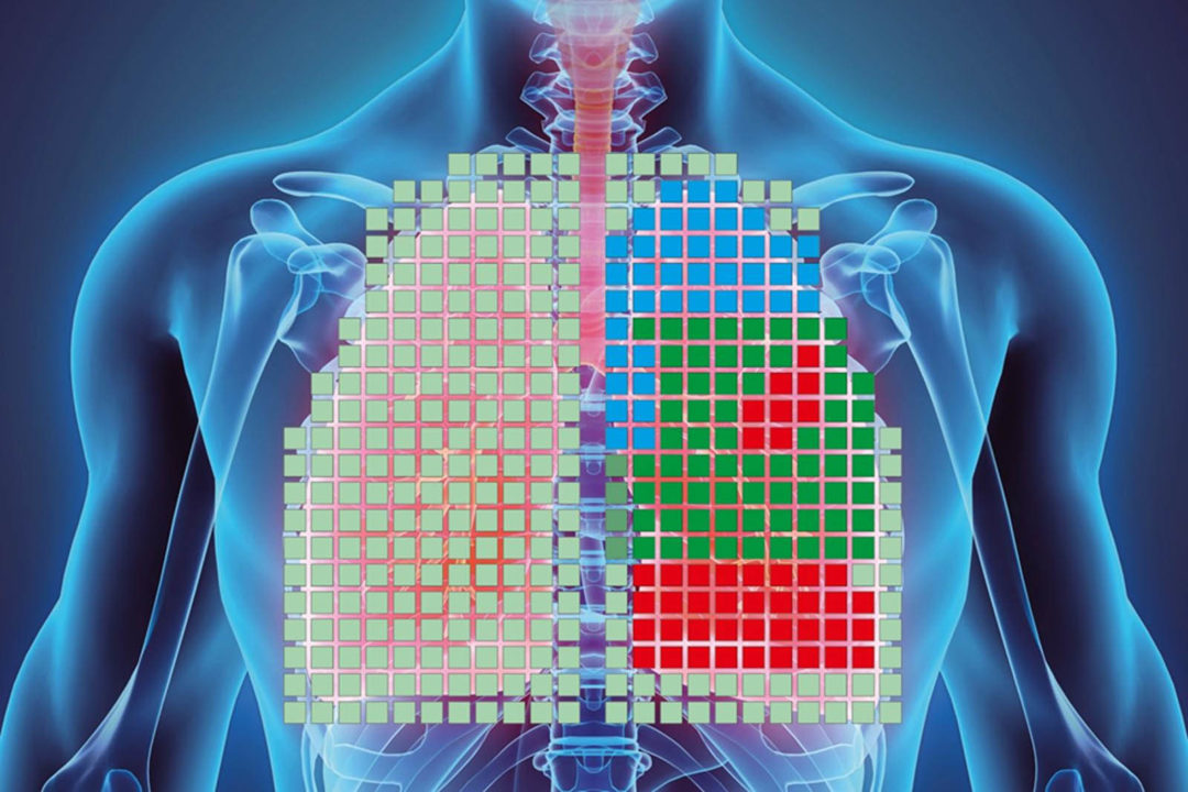 Vest monitors its wearer's lungs continuously - Textile Technology Source