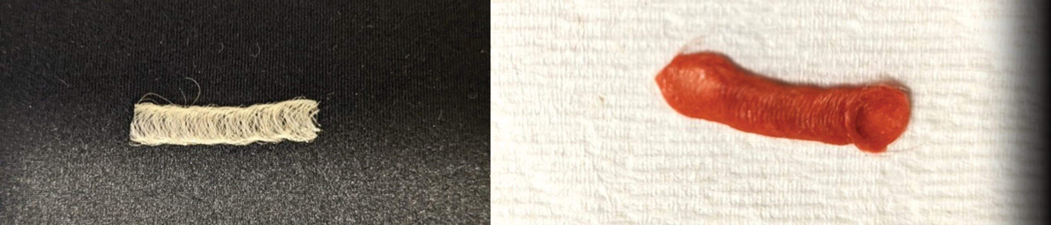 Persula Recent advances in biomedical textiles - Textile Technology Source
