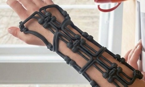 Black, foldable arm brace wraps around a hand and forearm, showcasing a flexible design with interconnected sections. Natural light in background.