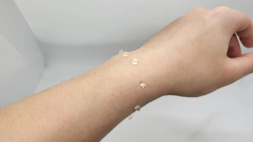Clear wearable medical monitor attached to a wrist, featuring a sleek design with small, discrete nodes along a thin, flexible band.