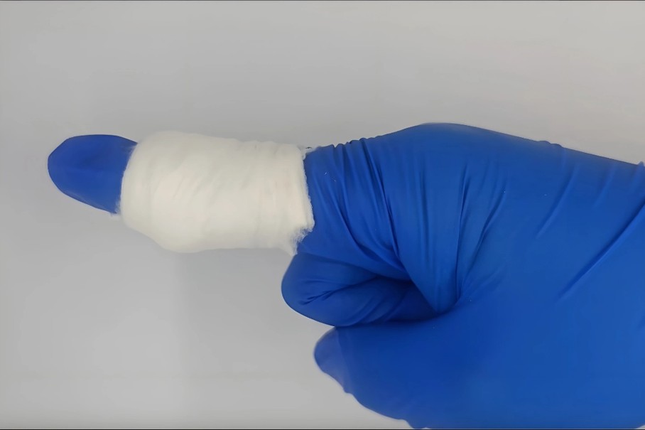 A bandaged finger wrapped in white cotton is shown, with a blue gloved hand in a neutral background.